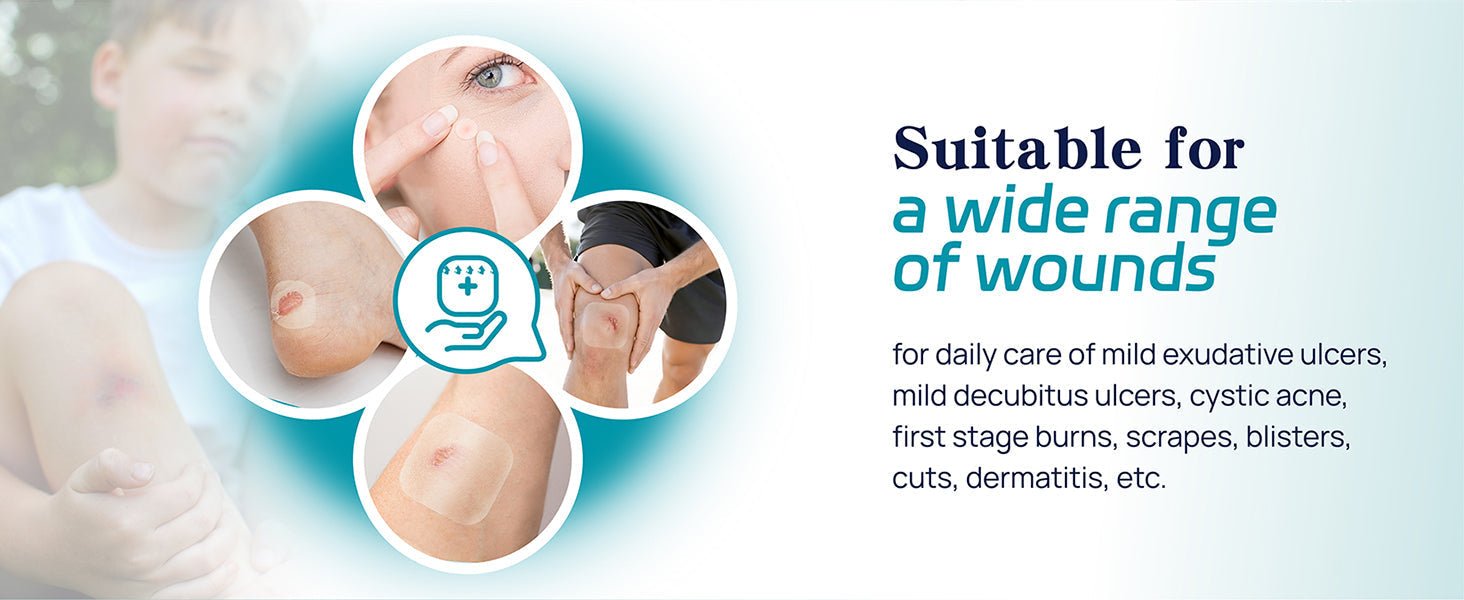 Can You Put a Hydrocolloid Dressing on an Open Wound?