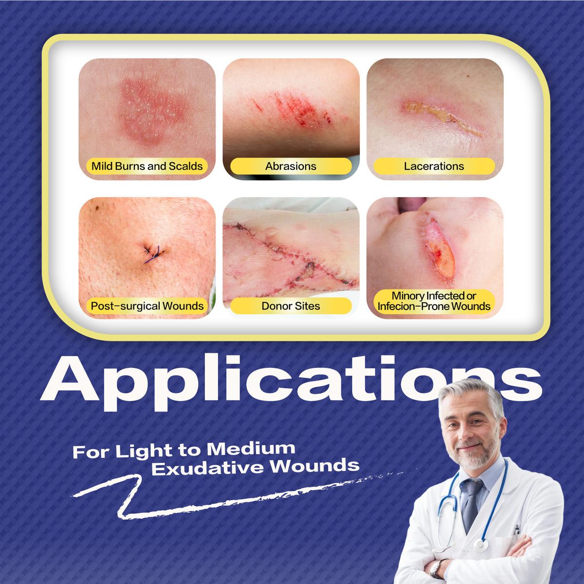 Xeroform Petrolatum Dressing for Minimally Draining Wounds, Surgical Incisons, Lacerations, Donor Sites, Burns, Skin Grafts