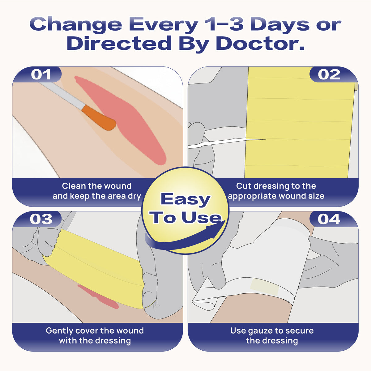 Xeroform Petrolatum Dressing for Minimally Draining Wounds, Surgical Incisons, Lacerations, Donor Sites, Burns, Skin Grafts