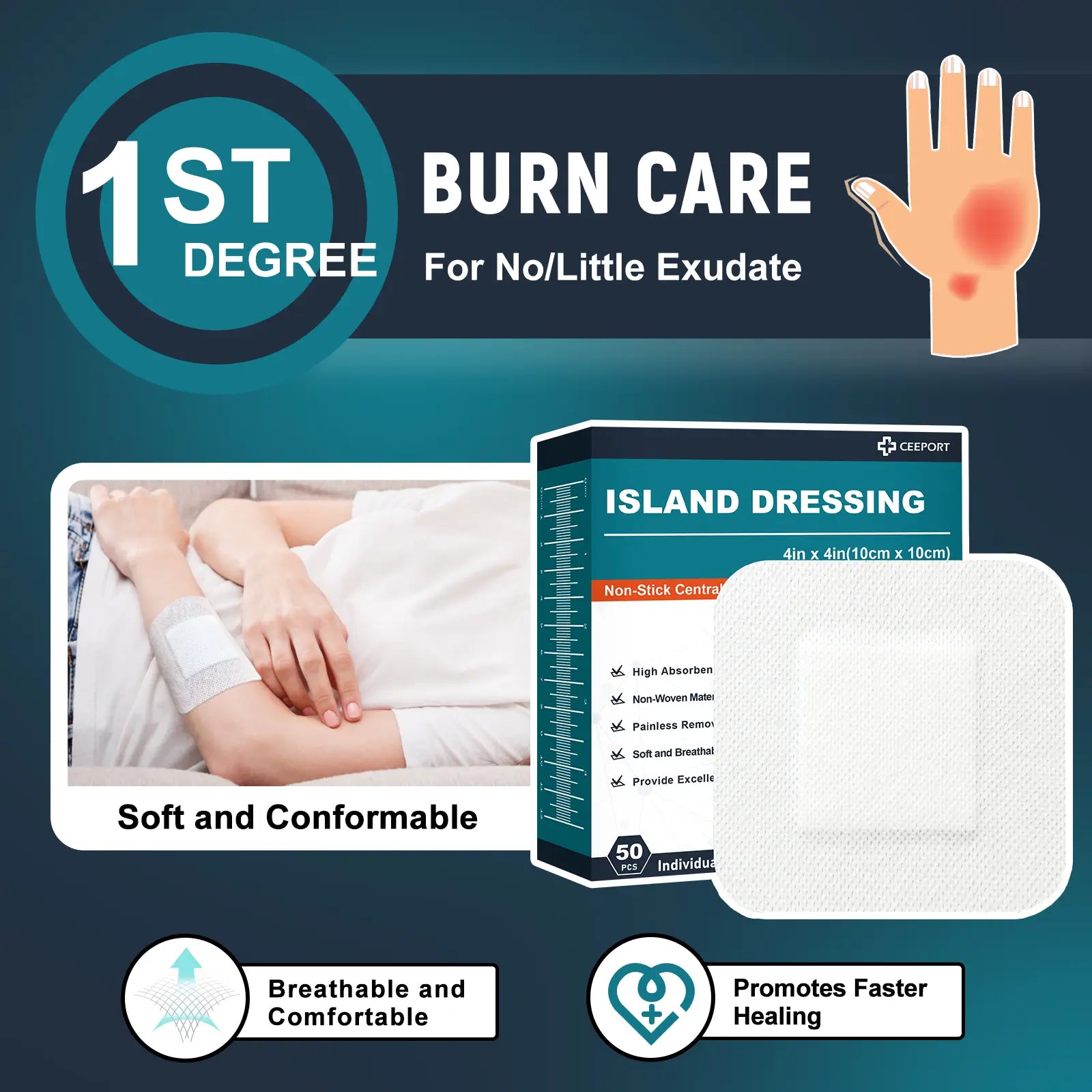 Island Non-Woven Dressing for First-Degree Burns | Soft & Protective CEEPORT Island Non-Woven Dressing for First-Degree Burns | Soft & Protective CEEPORT