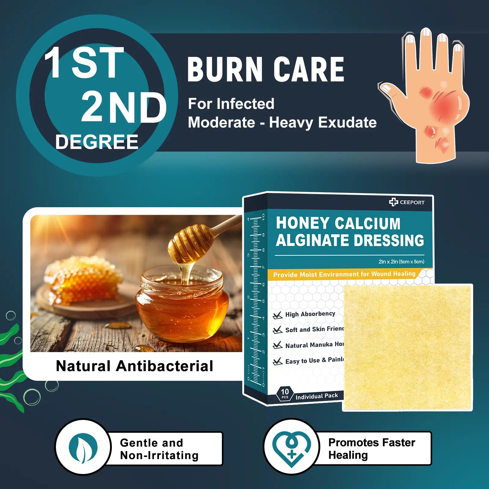 Manuka Honey Calcium Alginate Dressing for Infected Moderate And Heavy Exudate Wound