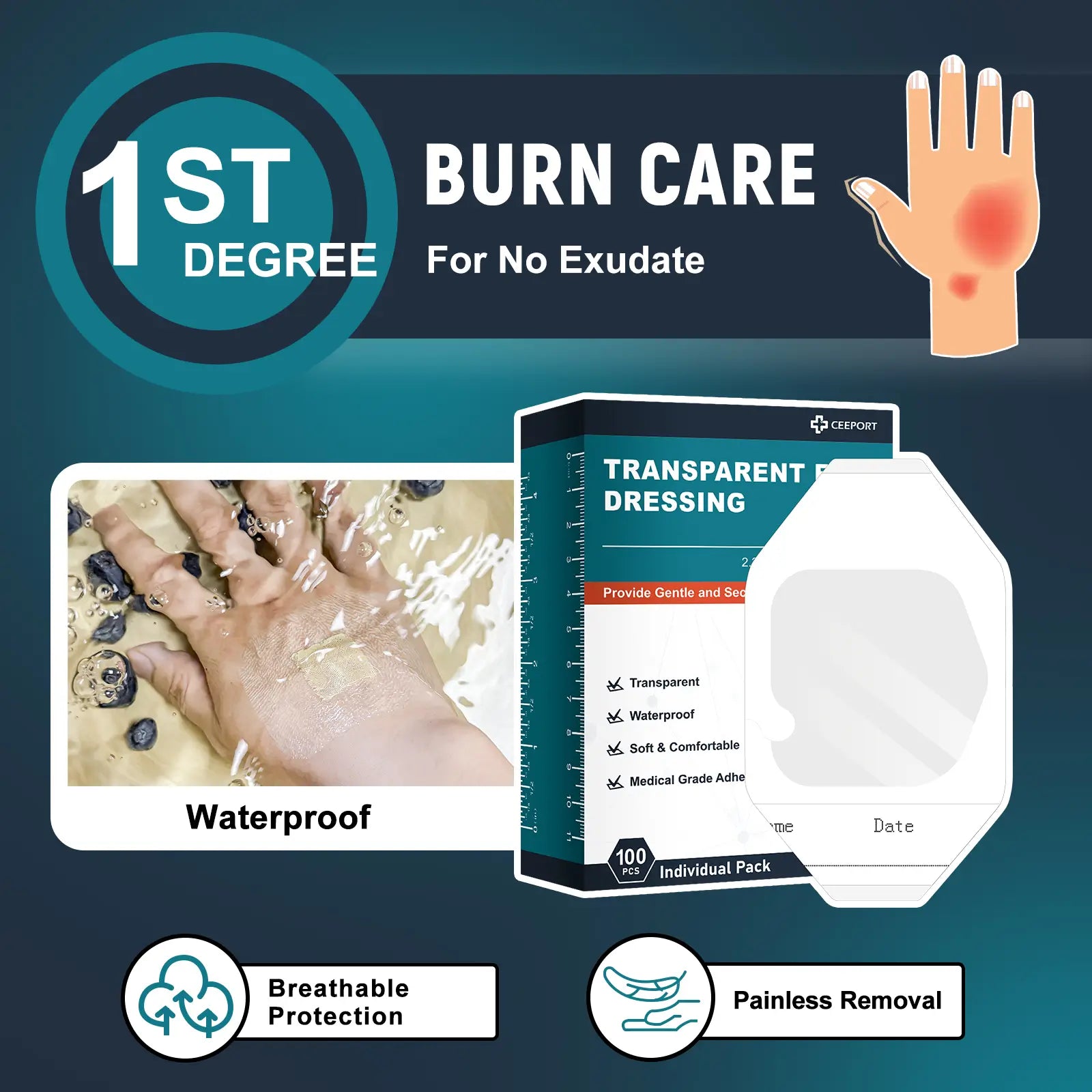 Transparent Film Dressing for No Exudate And Non-Infected Burn Wound