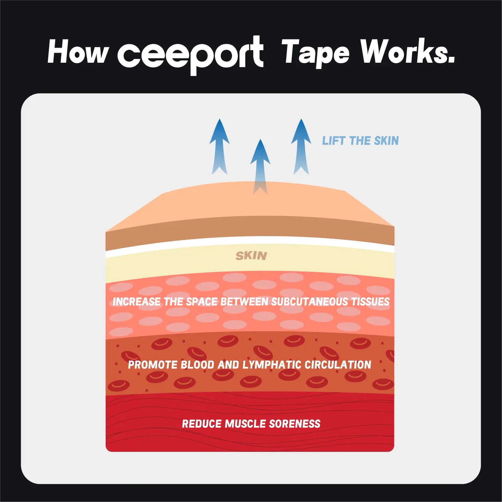 How Ceeport kinesiology tape works — lifting skin to improve circulation, reduce pain, and support muscles
