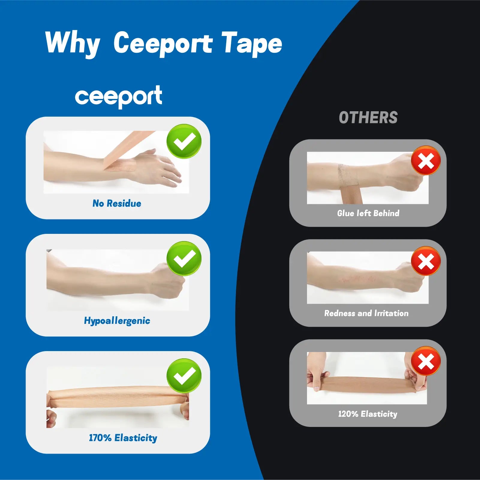 Ceeport kinesiology tape compared with other brands — better elasticity, hypoallergenic, and no residue