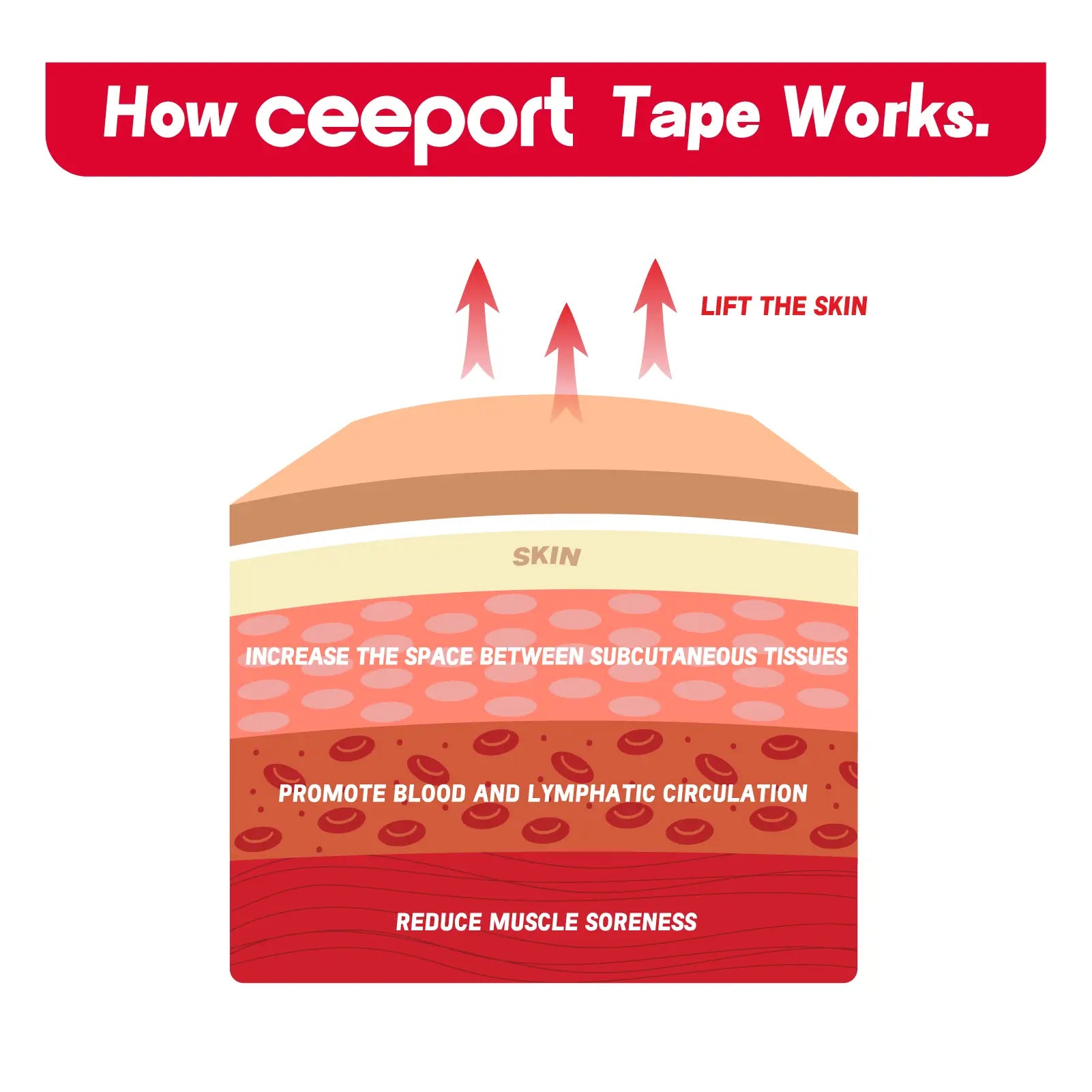 How Ceeport kinesiology tape works — lifting skin to improve circulation, reduce pain, and support muscles