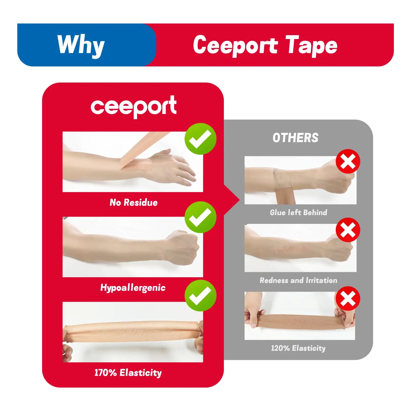 Ceeport kinesiology tape compared with other brands — better elasticity, hypoallergenic, and no residue
