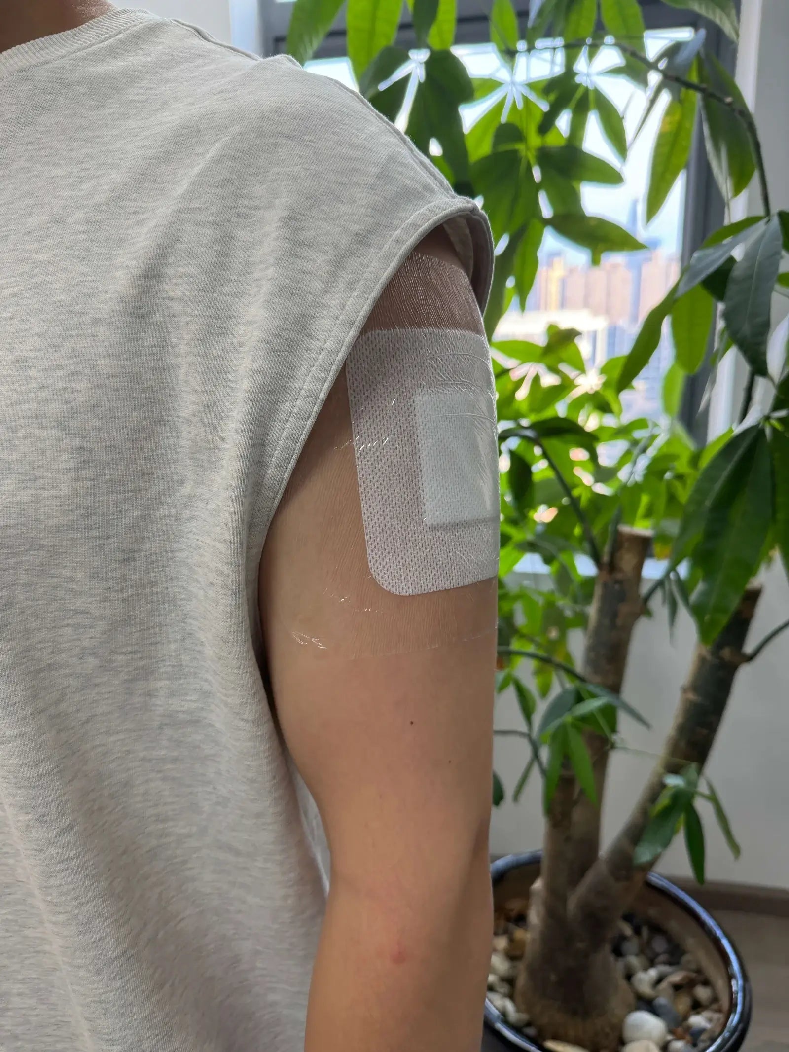 Non-woven dressing and transparent film dressing are applied on the arm wound