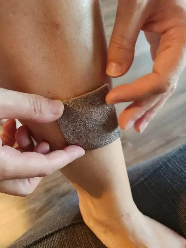 Silver alginate dressing for leg ulcer