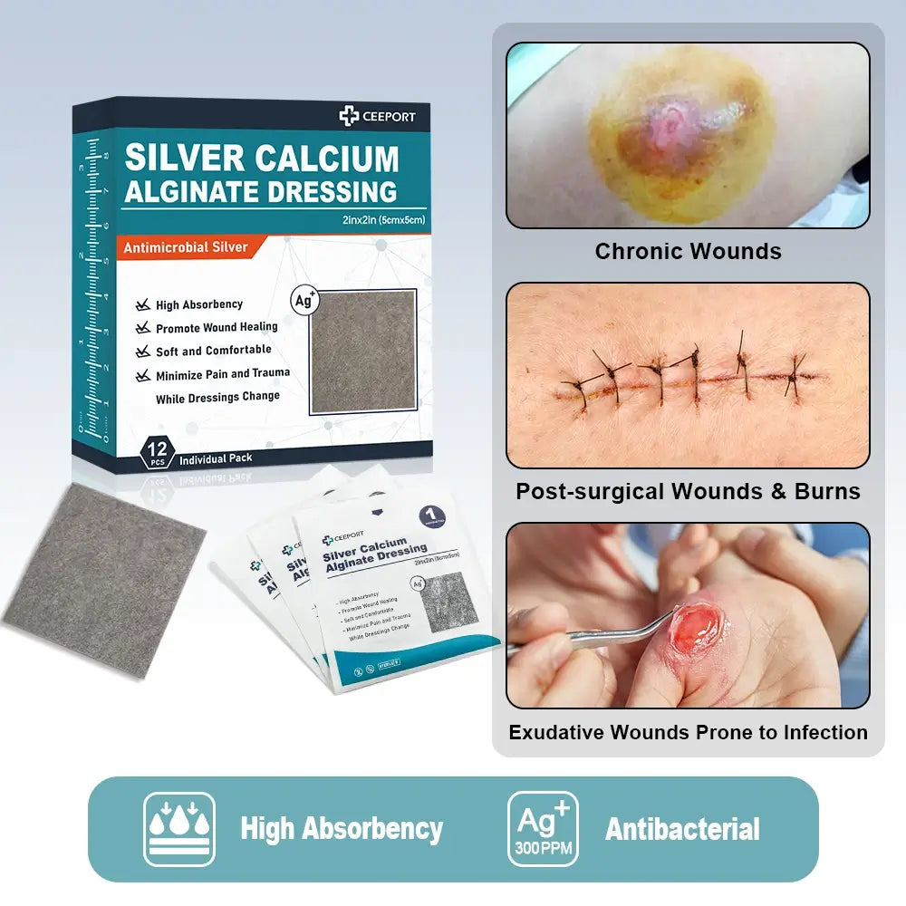 Silver ion alginate dressing is suitable for various wounds, such as surgical wound, pressure ulcer, leg ulcer, bedsore, diabetic ulcer and so on