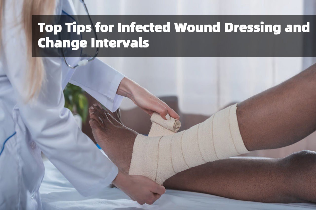 Top Tips for Infected Wound Dressing and Change Intervals