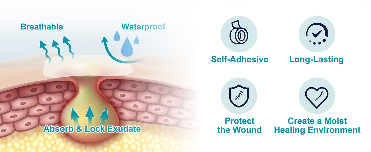 How to Tell If a Hydrocolloid Bandage Is Working?