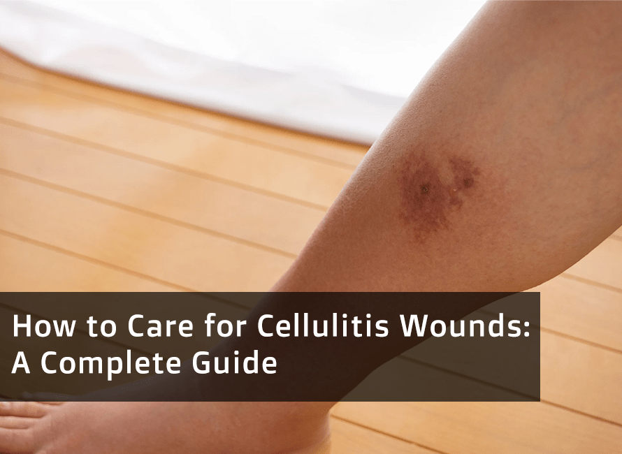 Cellulitis Dressing How to Care for Cellulitis Wounds: A Complete Guide – CEEPORT