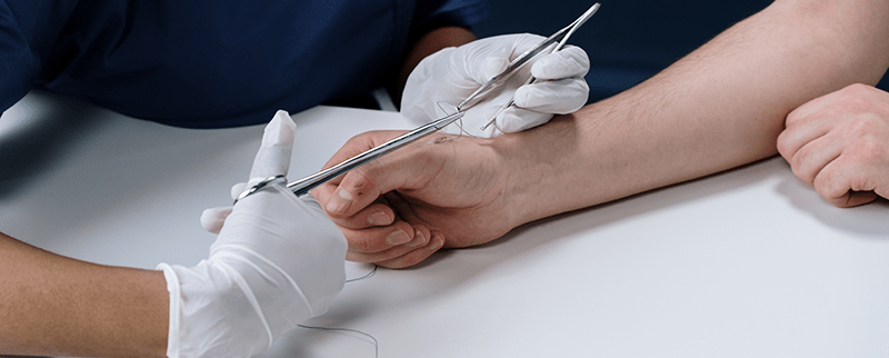 Why Choose Adaptic Wound Dressing? A Guide to Adaptic Wound Care
