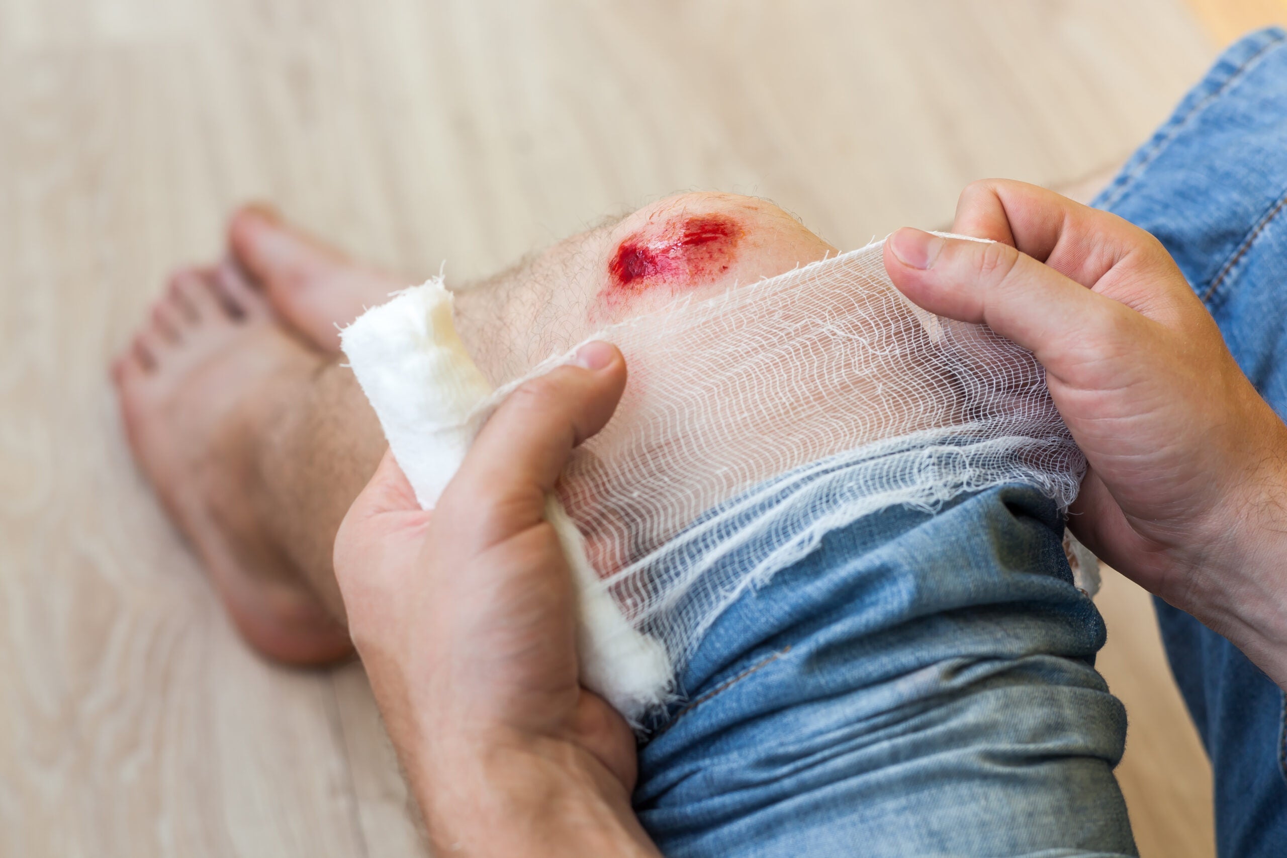 🩹 Wound Dressing for Skin Tear: Best Practices for Healing and Protection