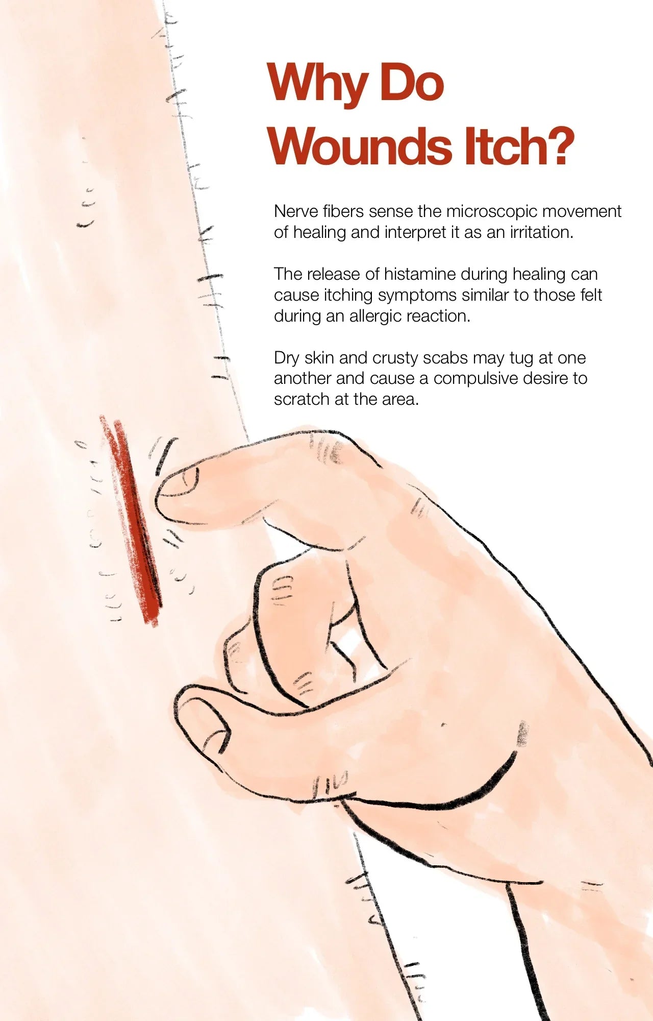 Wound Itching Under Dressing Explained: Stop Surgery Stitches Itchy the Right Way