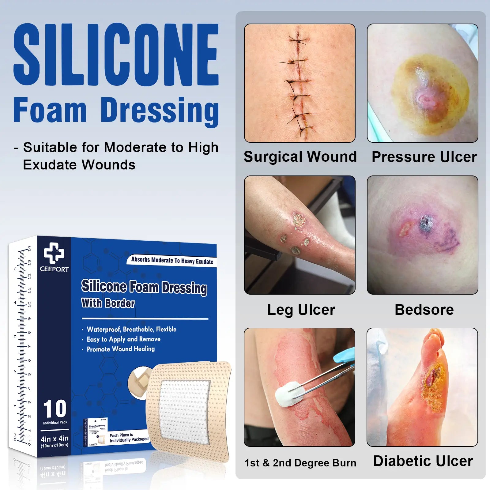 10cm silicone foam dressing suitable for moderate to high exudate wounds