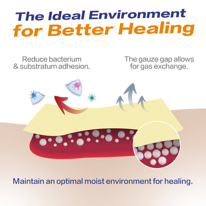 Xeroform Petrolatum Dressing for Minimally Draining Wounds, Surgical Incisons, Lacerations, Donor Sites, Burns, Skin Grafts