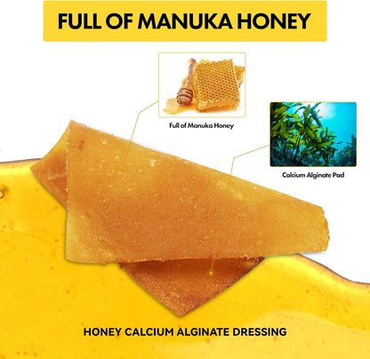 Moisture-Retaining Manuka Honey Calcium Alginate Dressing for Second-Degree Burns