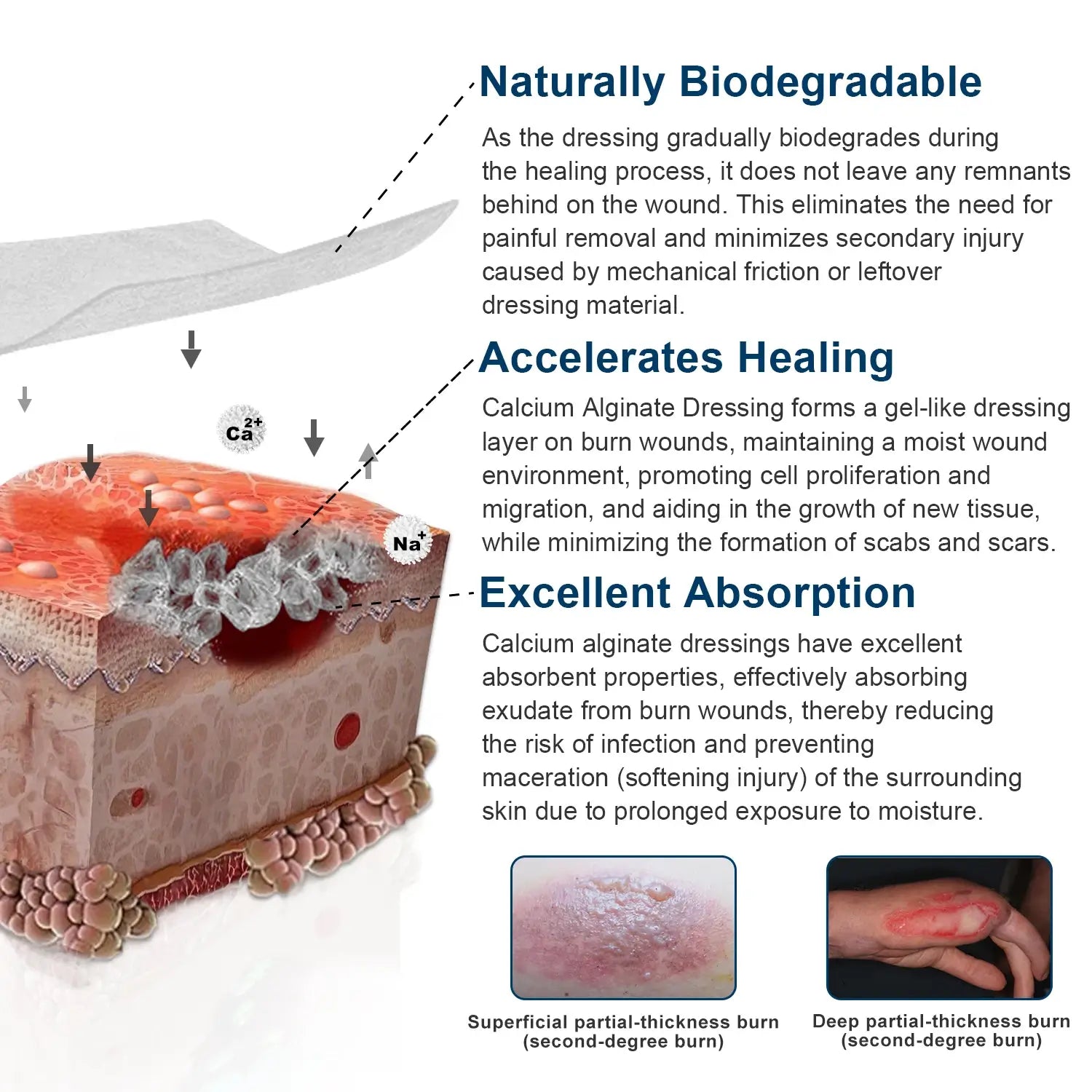 Calcium alginate wound dressing with natural biodegradability, accelerates healing, and superior absorbent capacity for faster wound recovery.