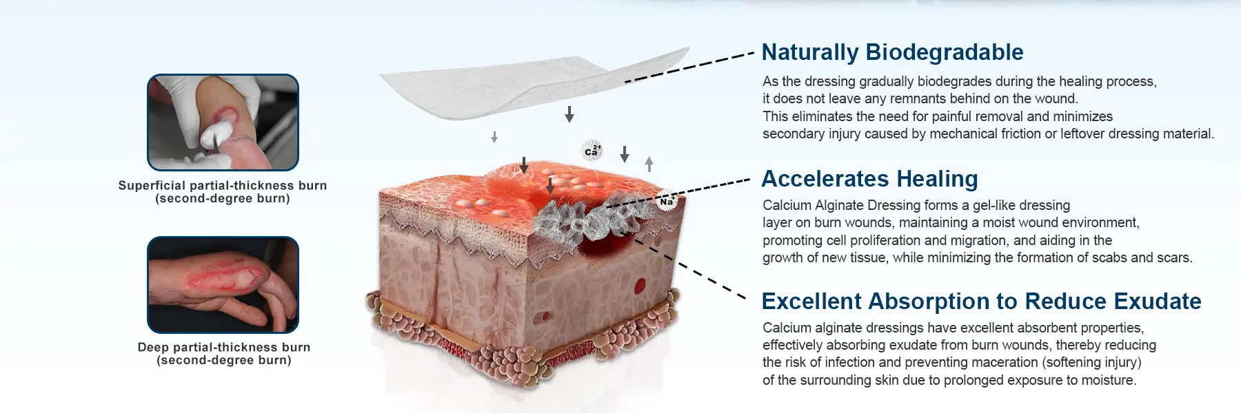 Calcium alginate dressing with natural biodegradability, accelerates healing, and superior absorbent capacity for faster wound recovery.