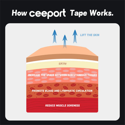 How Ceeport kinesiology tape works — lifting skin to improve circulation, reduce pain, and support muscles