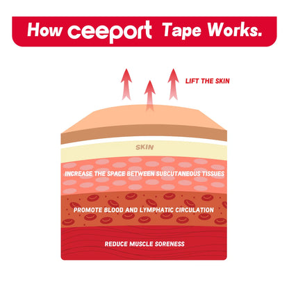 How Ceeport kinesiology tape works — lifting skin to improve circulation, reduce pain, and support muscles