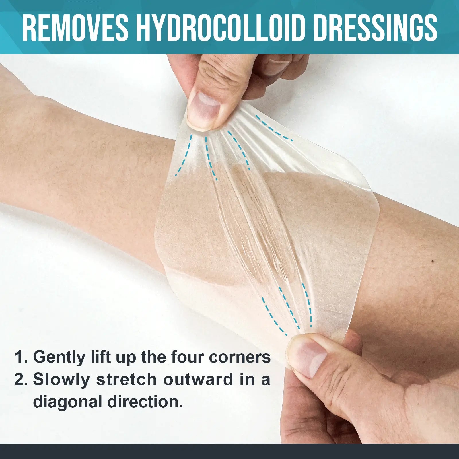 The hydrocolloid dressing is designed for easy removal, ensuring that the dressing can be changed without causing irritation or damage to the wound or surrounding skin. Especially suitable for long-term use and sensitive skin patients.