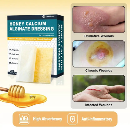 Manuka Honey Calcium Alginate Dressing for Cuts, Skin Tears, Abrasions, Burns, Diabetic Foot, Pressure Sores and Venous Ulcers