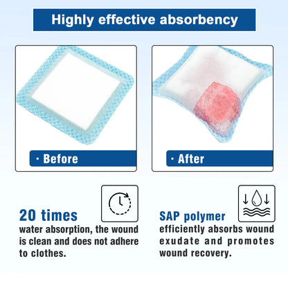 Highly absorbent dressing designed for effective wound care and moisture control