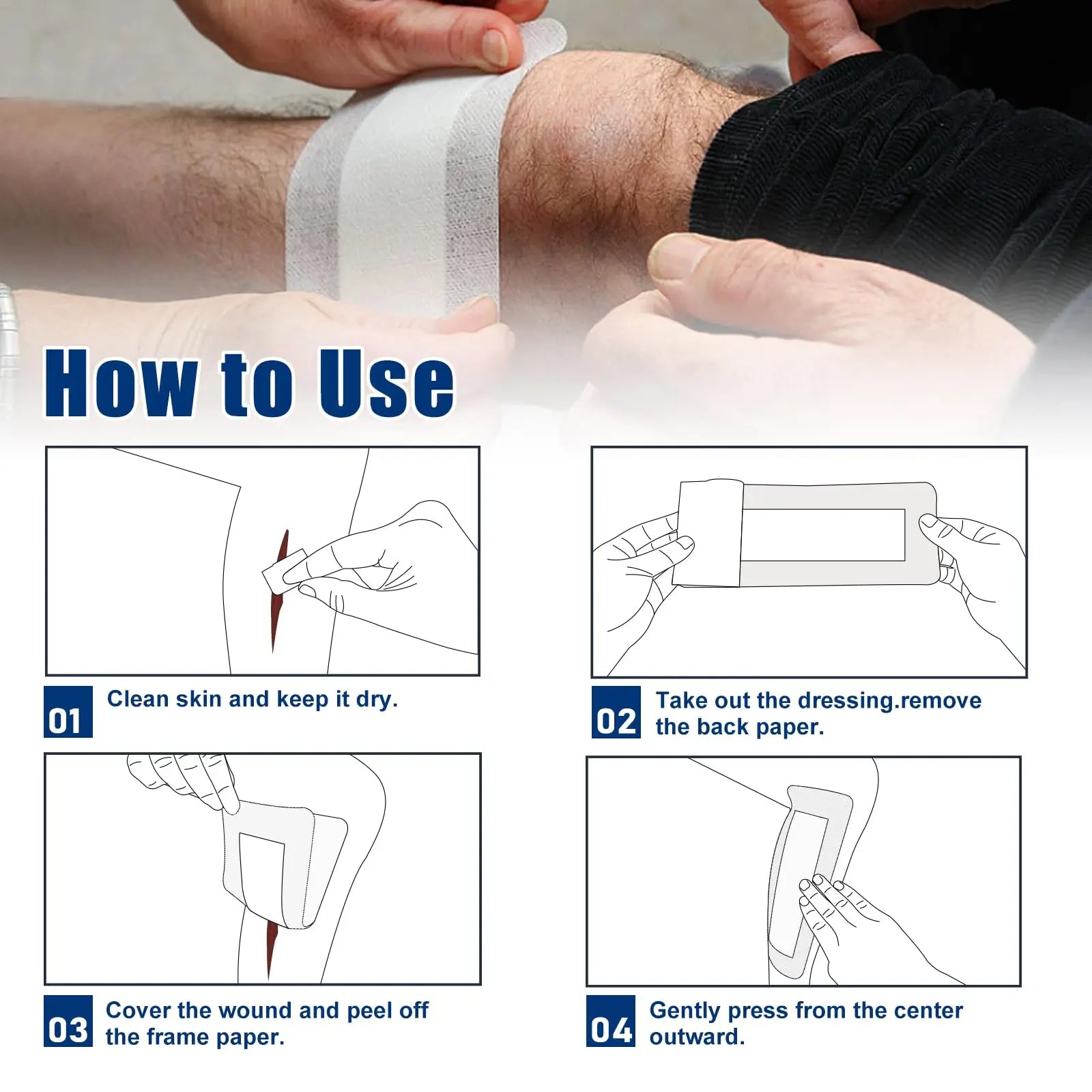 island wound dressing offering moisture resistance and wound protection