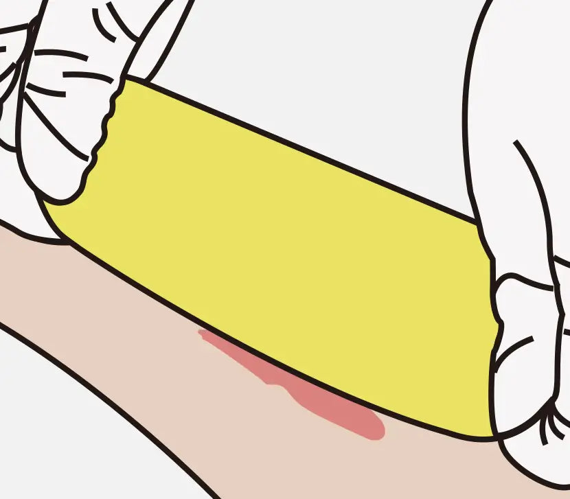 How to use xeroform petrolatum wound dressing