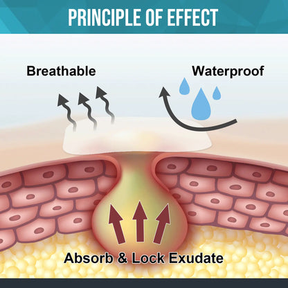 Waterproof performance of the hydrocolloid dressing, effectively preventing moisture from entering and keeping the wound dry, suitable for daily activities.