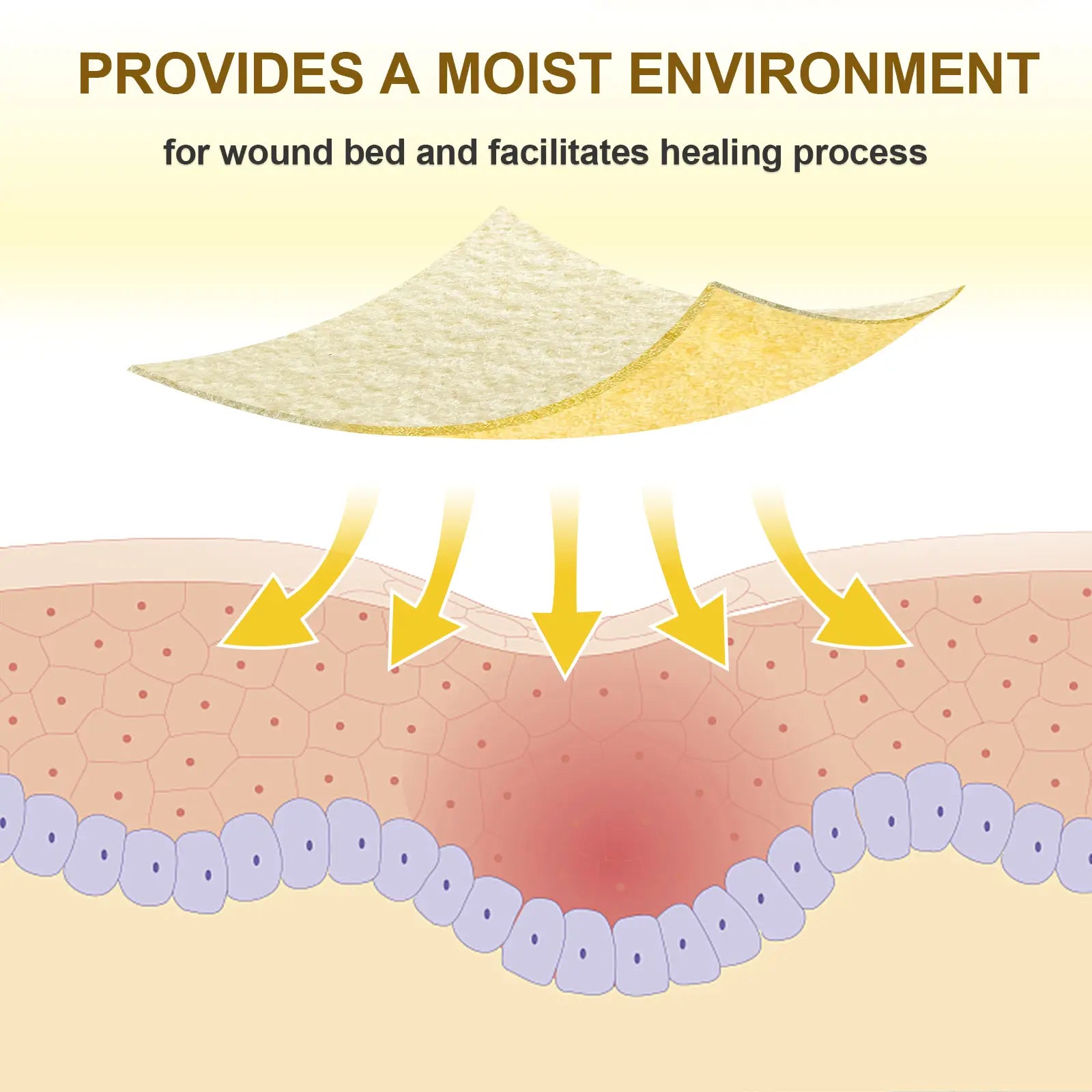 Manuka honey alginate dressing designed for moist wound healing and infection prevention