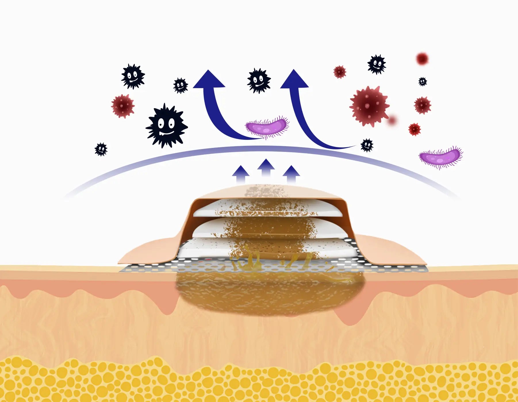 Innovative Multi-layer Silicone Foam Dressing with Outstanding Absorbency