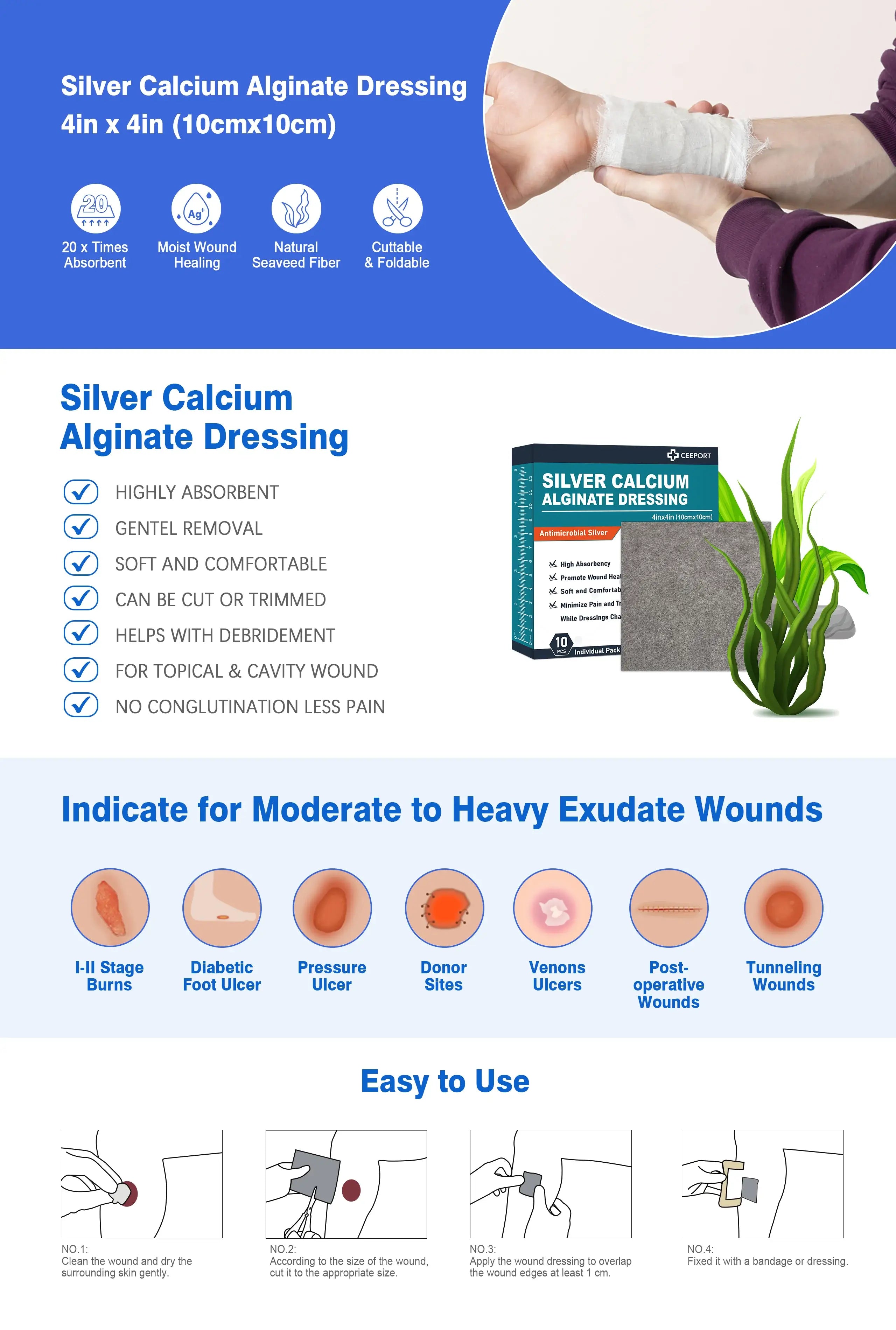 Silver ion alginate dressing designed for treating infected wounds