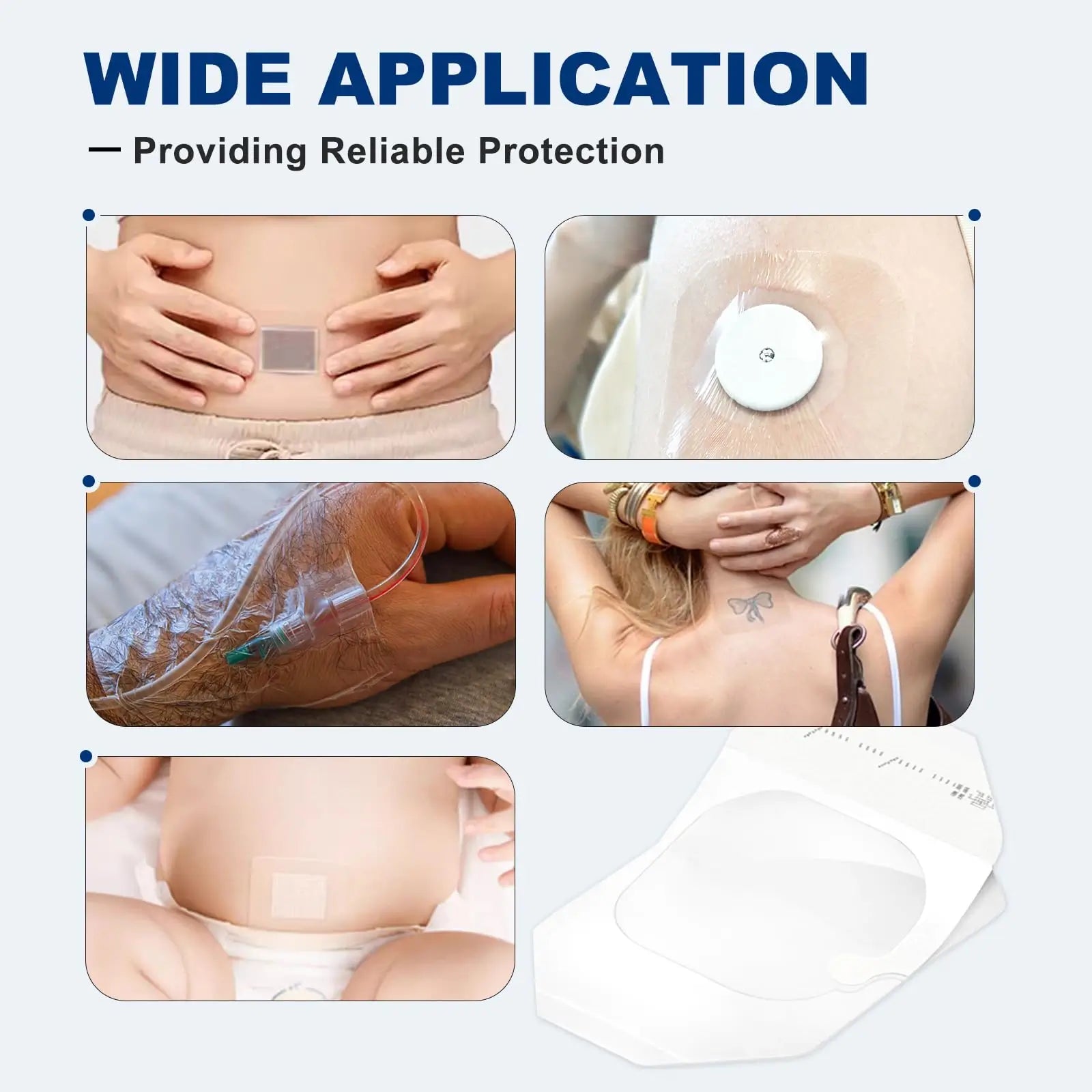 Sterile transparent film wound dressing designed for safe and effective wound coverage, wide application